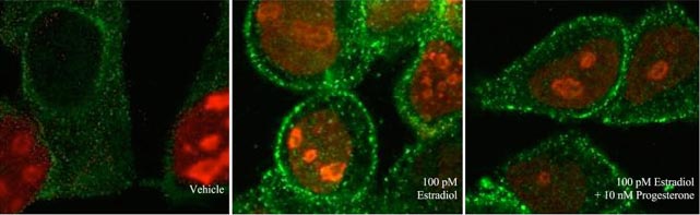 RANKL-containing vesicles image
