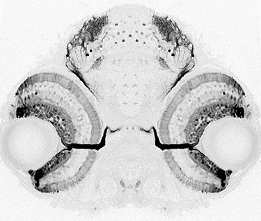 black and white image of retina and tectum