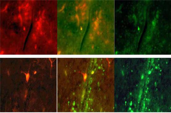 double_stained_gnrh_avt