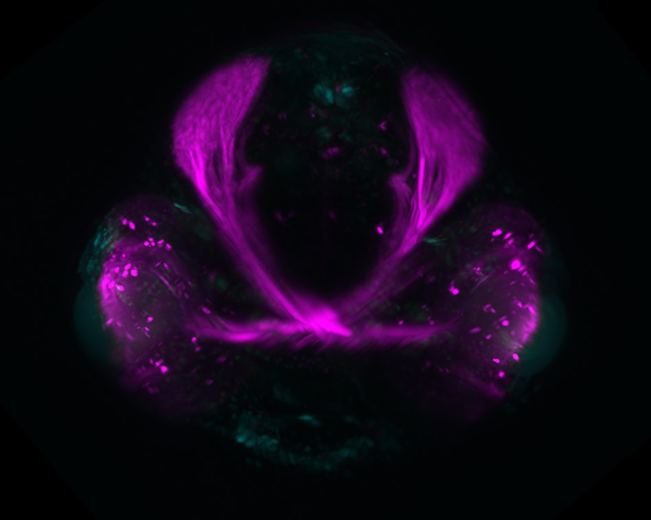 a single frame from a timelapse image showing the visual system of zebrafish. The neurons in the eye that project to the brain and then the optic nerve are in magenta. The cyan staining highlights a number of other structures in the fish.